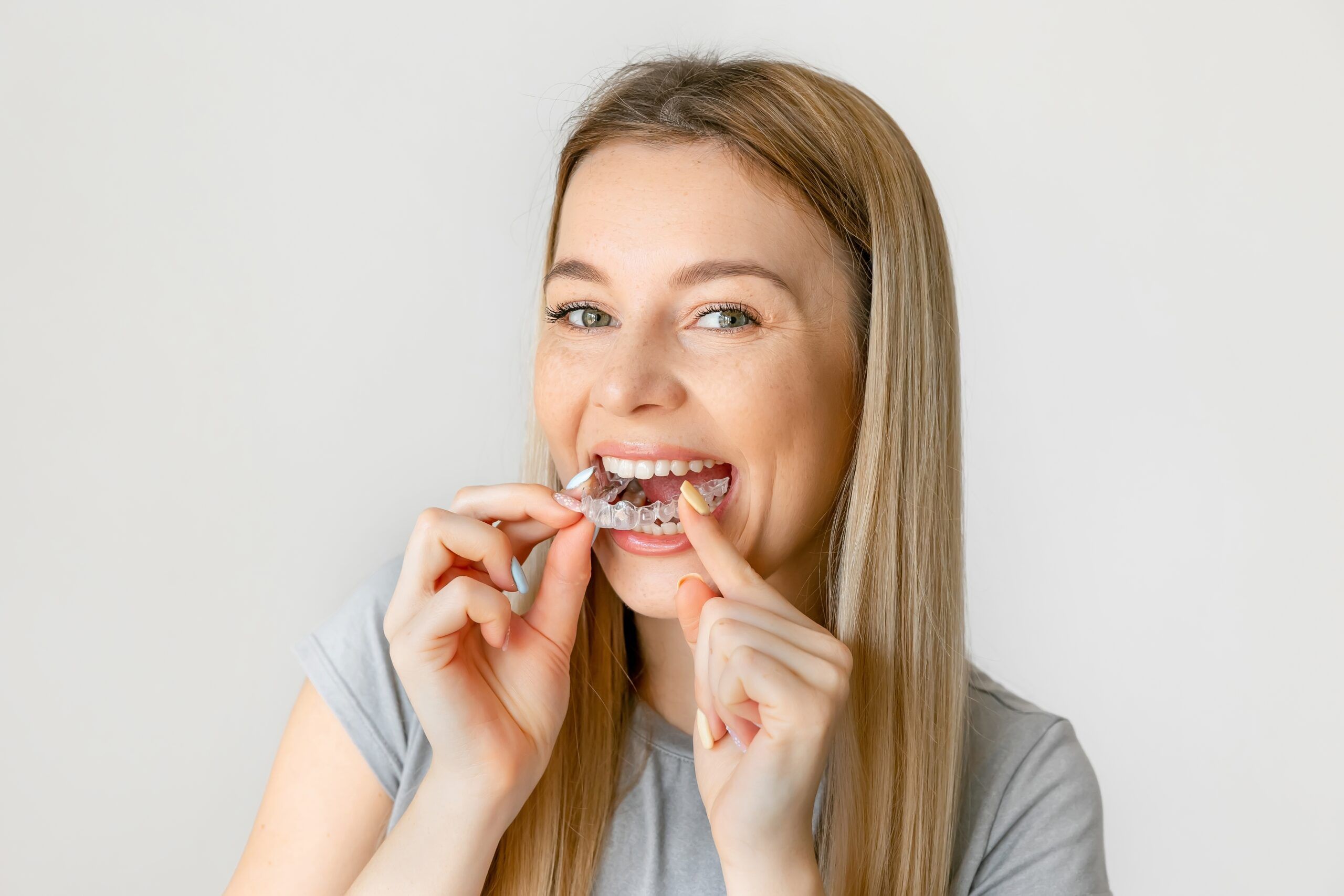 woman smiling as she inserts her retainers after braces treatment is completed