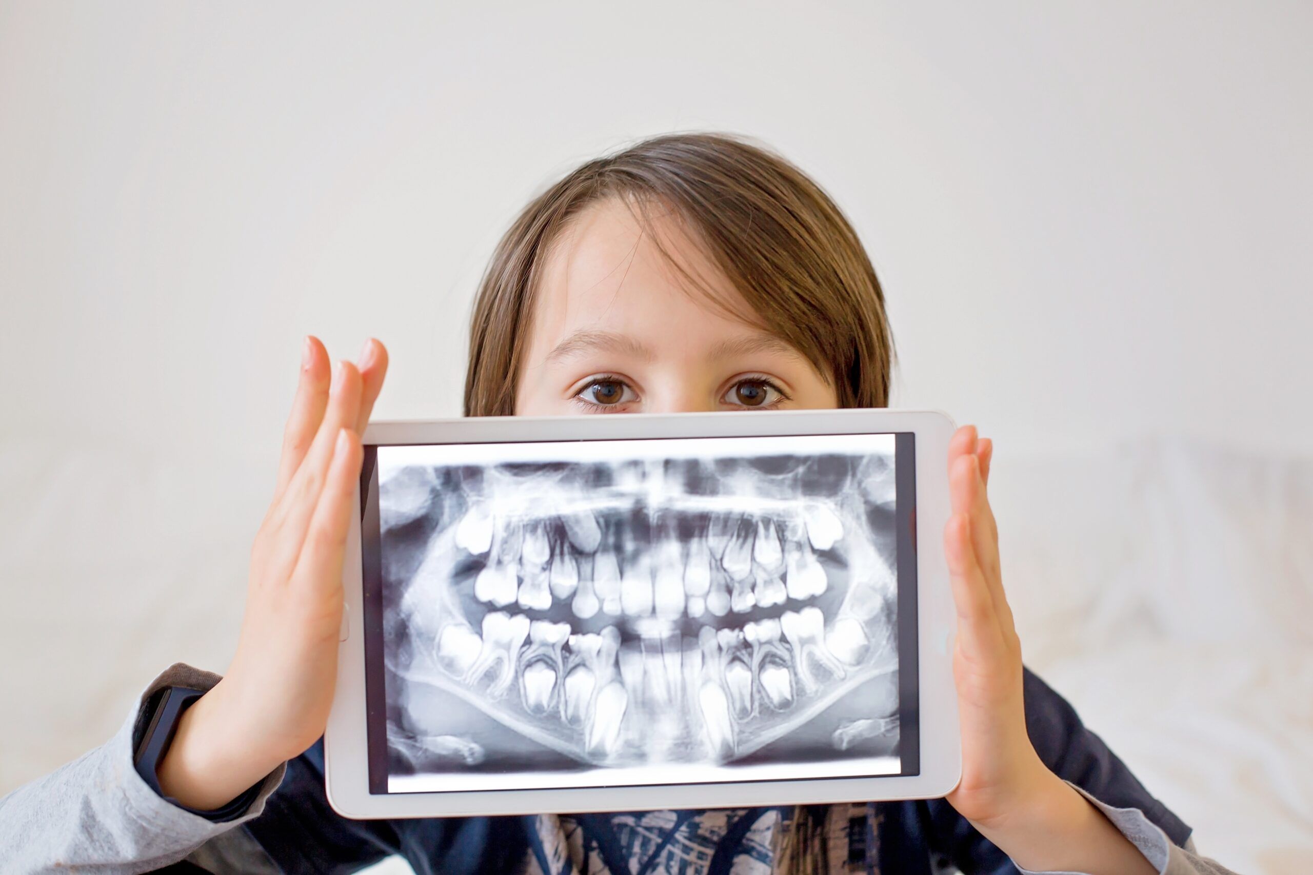 little boy holding up a full mouth x-ray